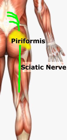 What are some symptoms of sciatica?